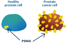 Healthy prostate cell vs prostate cancer cell