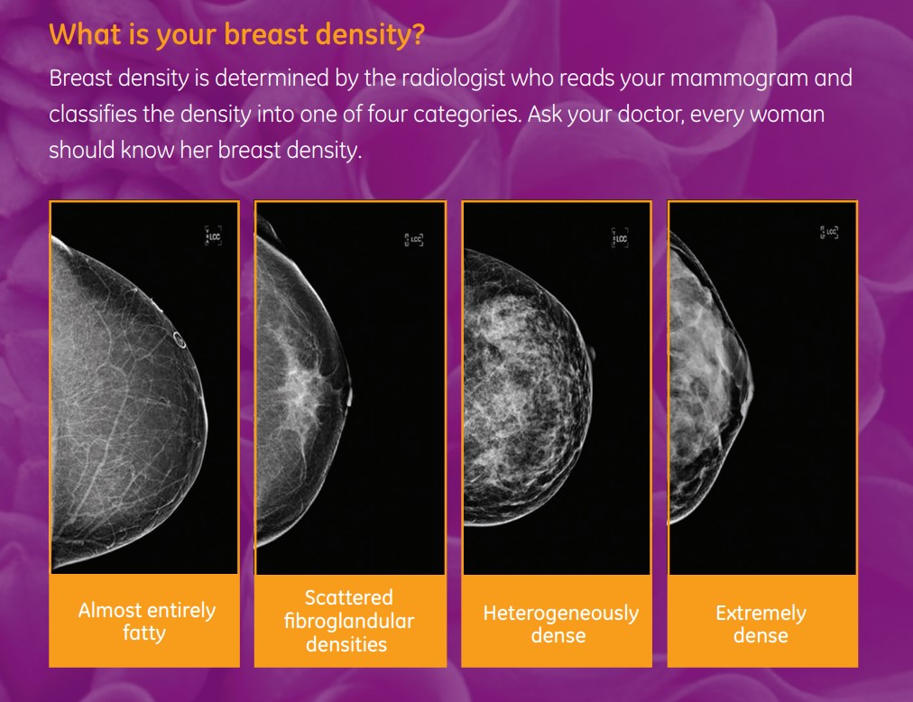 What is your breast density graphic